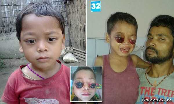 گریه خون پسربچه هندی